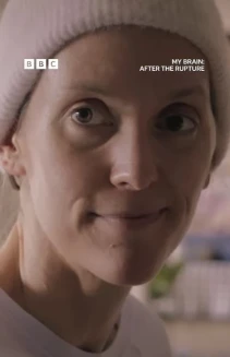 My Brain: After the Rupture